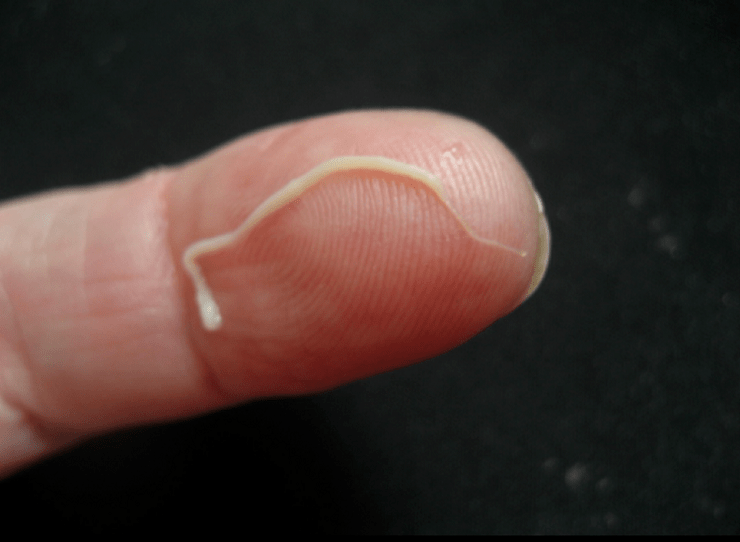 人体的蛔虫寄生虫